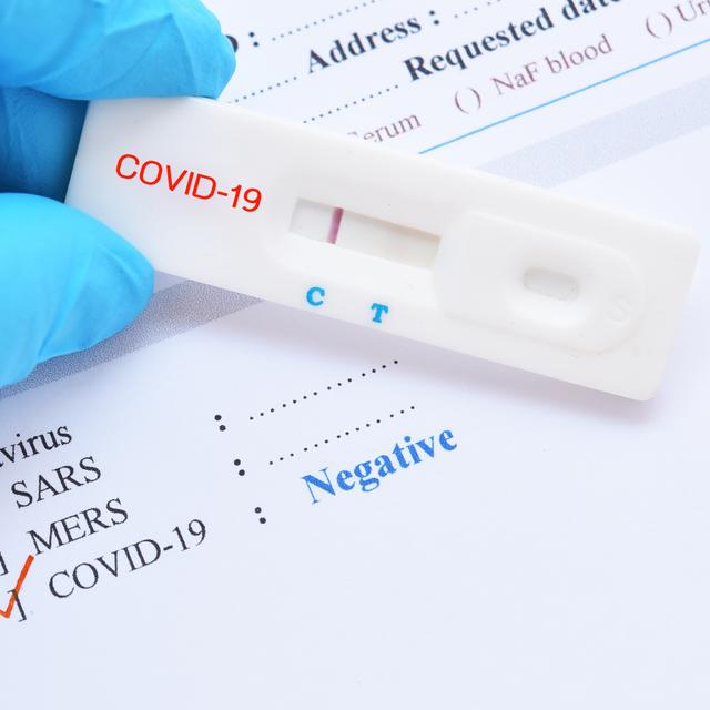 Les tests antigéniques réalisés en pharmacie et les auto-tests sont basés sur le même principe. © jarun011, Adobe Stock