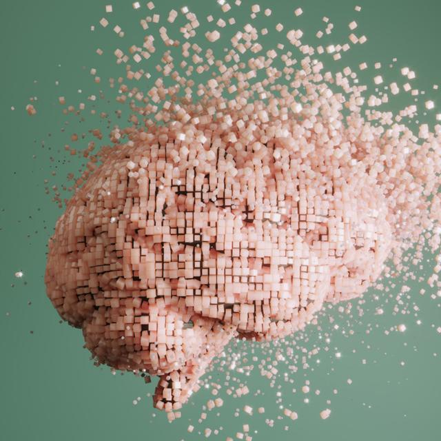 Alzheimer : une récupération du cerveau jugée impossible vient d’être ...