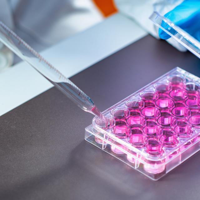 Le chercheur en biologie mène sans arrêt de nouvelles expérimentations afin de faire progresser la science. © Microgen, Fotolia.