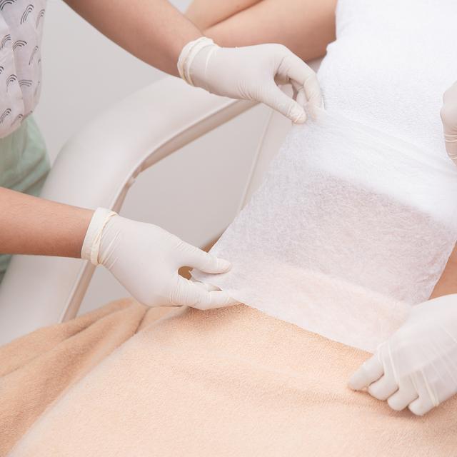 Définition Cryolipolyse qu'estce que c'est ? Futura santé — free download