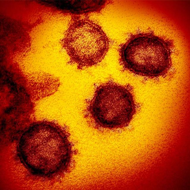 Une photo prise au microscope électronique du SARS-CoV-2, l'agent étiologique de la maladie Covid-19. © NIAID-RML 