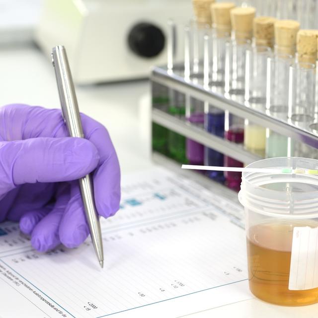 Le toxicologue analyse en laboratoire les conséquences des effets nocifs de substances toxiques sur la santé humaine. © Gerhard Seybert, Fotolia.