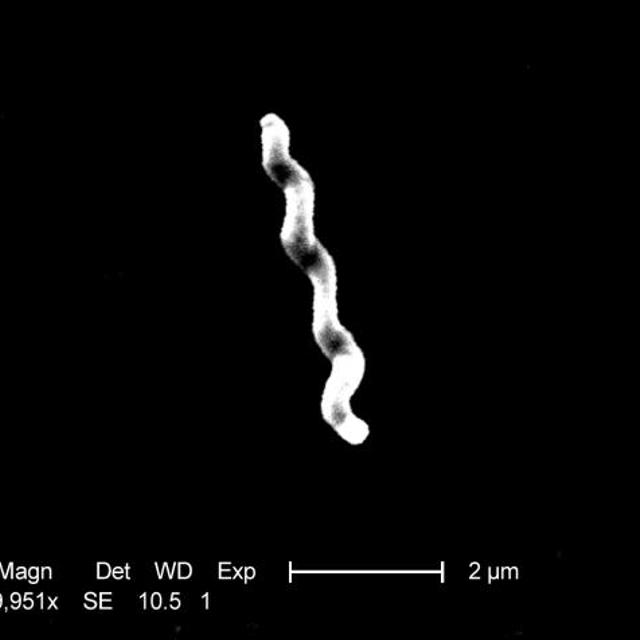 Ceci n&#39;est pas une pâte. Il s&#39;agit de&amp;nbsp;la bactérie intestinale Campylobacter jejuni, connue depuis 2007 pour engendrer l&#39;anxiété chez la souris. Or, on sait que chez certains, l&#39;humeur interfère beaucoup avec l&#39;appétit, dans un sens comme dans l&#39;autre...&amp;nbsp;© P. Fields, C. Fitzgerald, CDC, DP