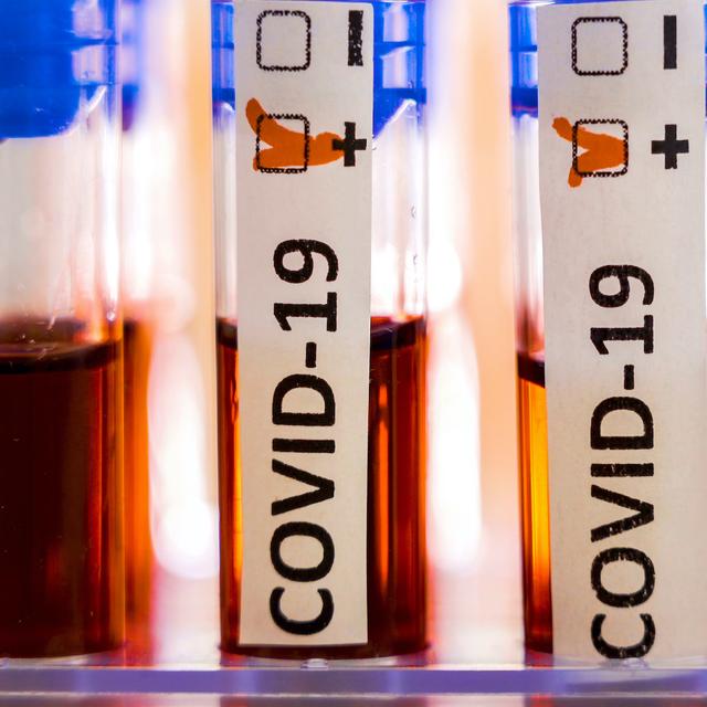 Coronavirus : on peut être infecté plusieurs fois de suite. © Nordicstocks, Adobe Stock