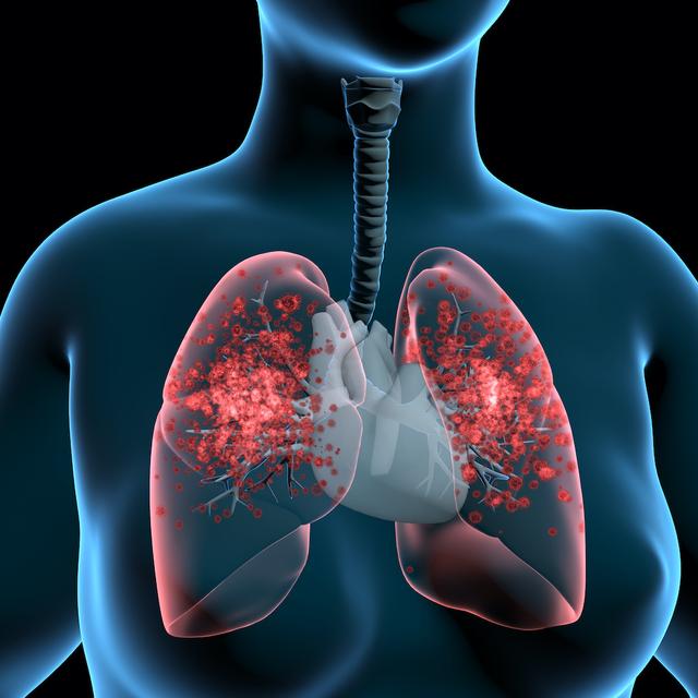 Le SARS-CoV-2 peut être transmis via une transplantation pulmonaire. © TuMeggy, Adobe Stock