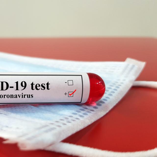 Les patients souffrant de symptômes persistants de la&amp;nbsp;Covid-19 produisent des auto-anticorps spécifiques. © Joel bubble ben, Adobe Stock