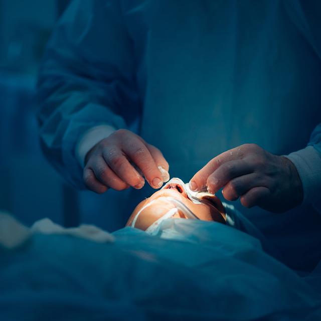 Chirurgie du nez. © Alfa 27, Adobe stock&nbsp;
