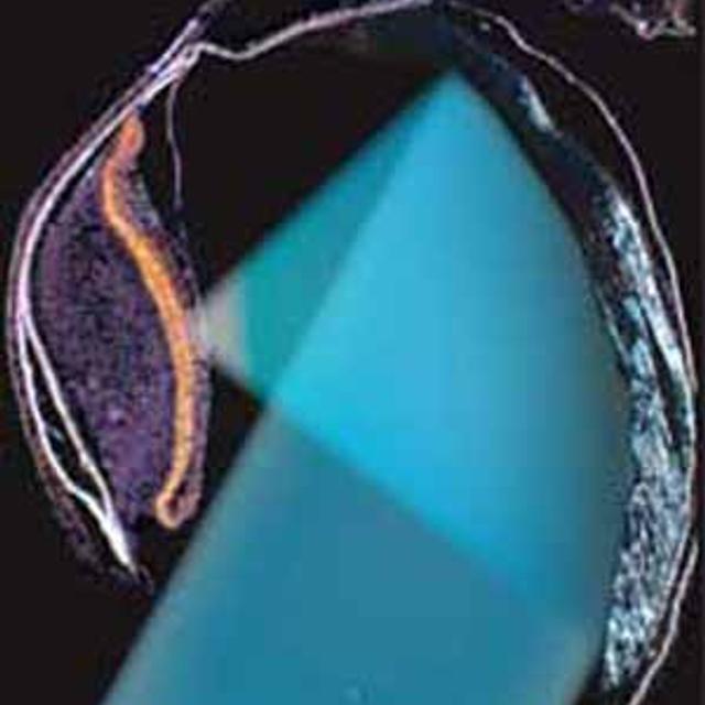 Coupe de l’œil du spookfish. Crédit : Hans-Joachim Wagner/Université de Tübingen