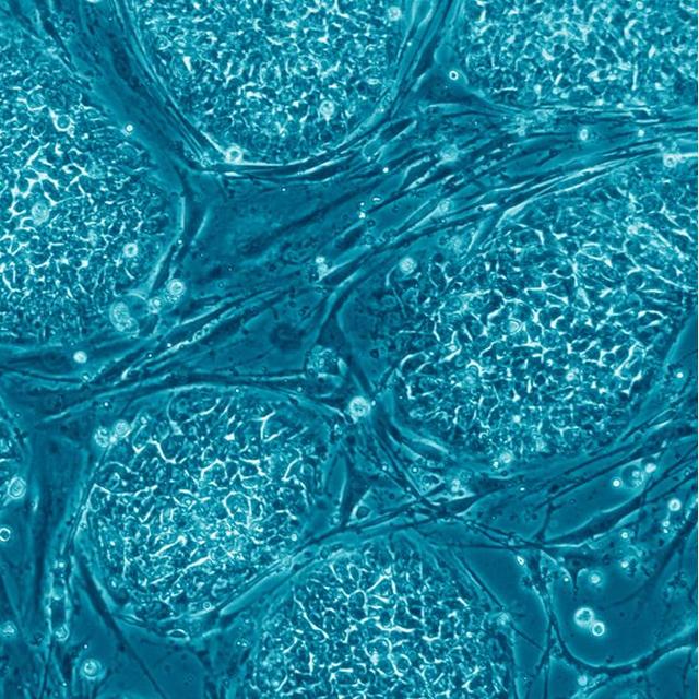 Les cellules souches sont à la base de la médecine régénérative, car elles sont pluripotentes, et peuvent se différencier en n&#39;importe quel tissu. Mais elles posent des problèmes éthiques et sanitaires, alors les chercheurs tentent d&#39;autres moyens de régénérer des organes et leurs fonctions. La reprogrammation cellulaire en est un bon exemple ! © Eugene Russo, Plos One, cc by 2,5