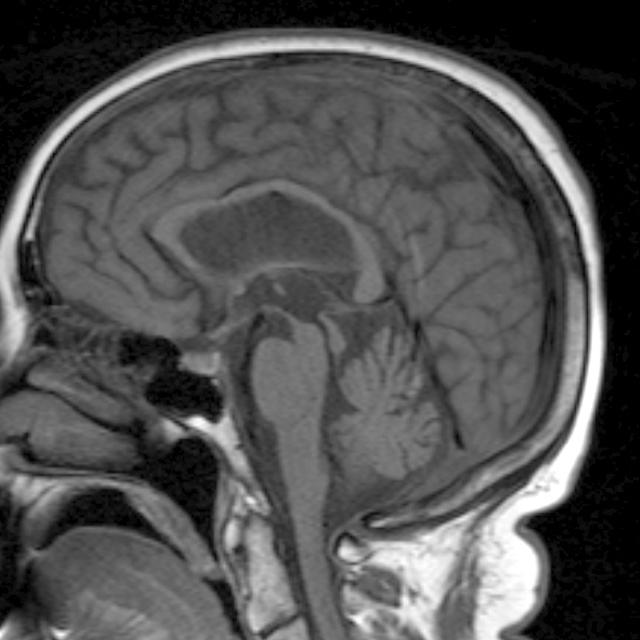 Un cerveau humain, c&#39;est environ 100 milliards de neurones connectés les uns aux autres. Aucun autre organe n&#39;est aussi complexe. Peu à peu, les scientifiques déroulent le fil d&#39;Ariane et arrivent à tracer des chemins dans ce labyrinthe.&amp;nbsp;© Heidi Cartwright, Wellcome Images, Flickr, cc by nc nd 2.0