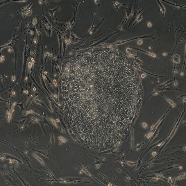 Ces cellules de peau humaine se sont transformées en cellules totipotentes après l’introduction de quatre gènes. © Junying Yu