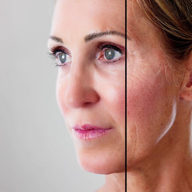 Chirurgie esthétique avant et après intervention. © Andrey Popov, Adobe Stock