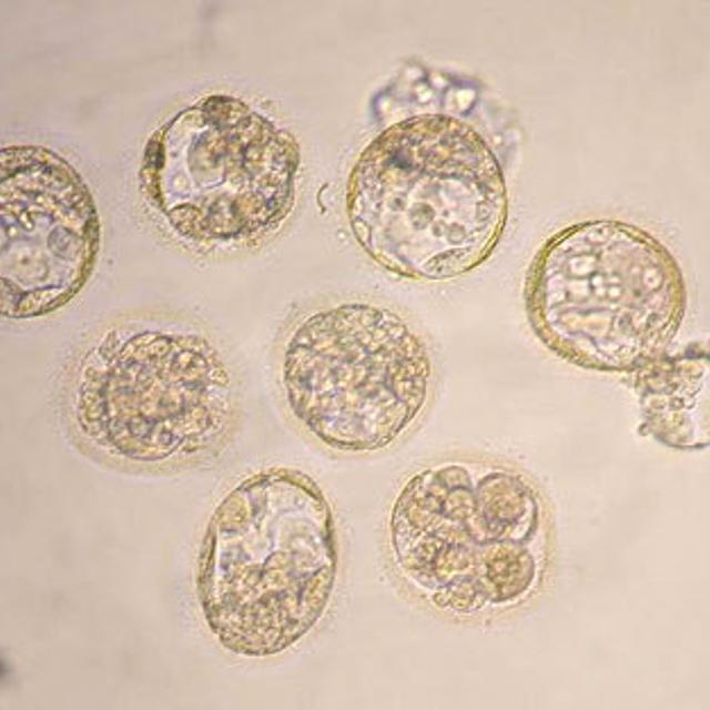 Embryons Humains au stade &quot;blastocystes&quot;