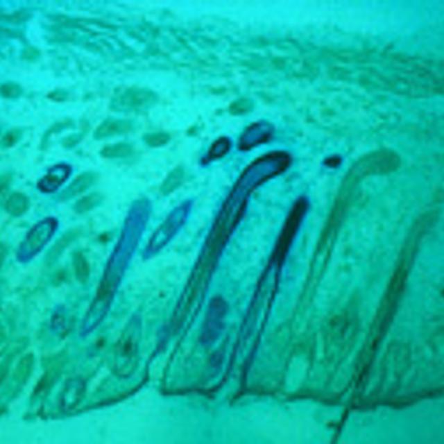 Identification des cellules souches capables de régénérer l&#39;épiderme, les glandes sébacées et les follicules pileux. Greffe de cellules souches sur la peau du dos d&#39;un embryon de souris.Crédits : INSERM