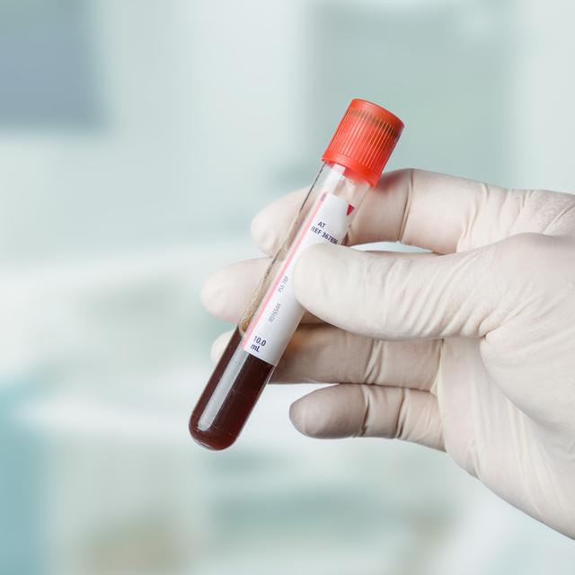 Définition | Facteur Rhésus : qu'est-ce que c'est ? | Futura santé