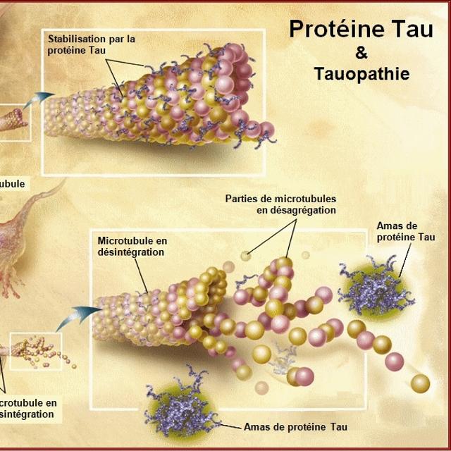 Zona causes, symptômes et traitements — free download