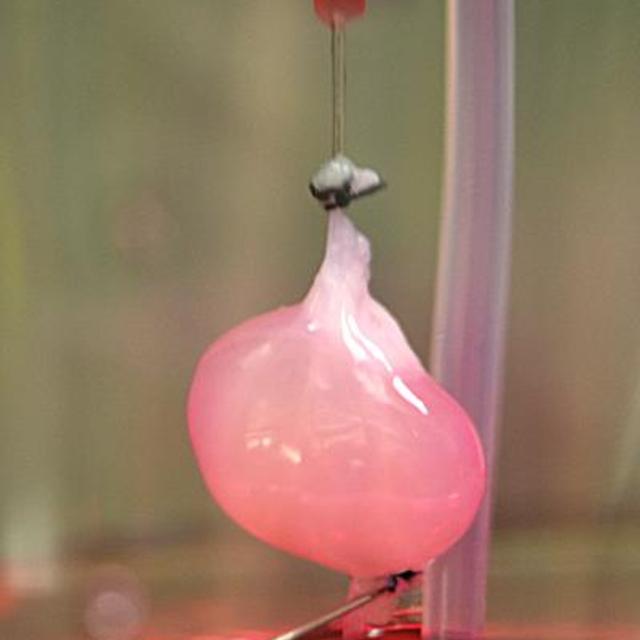 Le rein a pour fonction de filtrer le sang et de collecter les déchets pour les expulser à travers l&#39;urine. Celui à l&#39;image a été recréé après la destruction de toutes les cellules préalablement existantes sur l&#39;organe d&#39;un donneur dont seule l&#39;architecture a été conservée par ajout de lignées cellulaires. Un espoir pour tous les patients victimes d&#39;insuffisance rénale.&amp;nbsp;©&amp;nbsp;Ott Lab,&amp;nbsp;Center for Regenerative Medicine, Massachusetts General Hospital