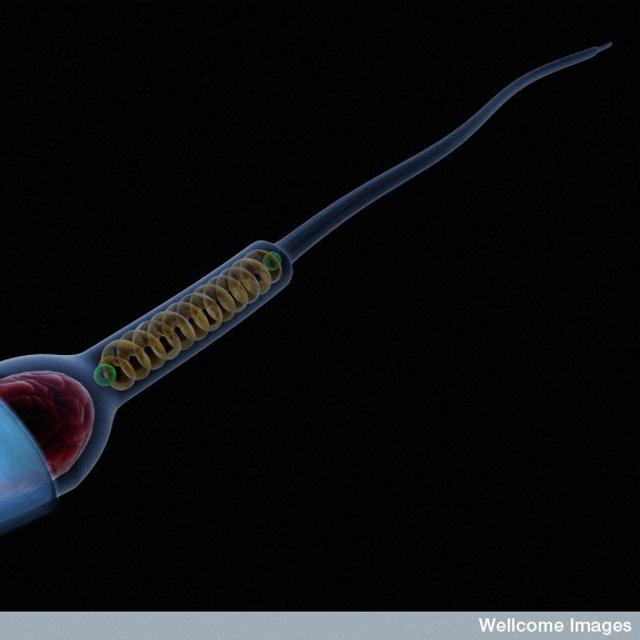 Chaque spermatozoïde possède un génome&amp;nbsp;unique car il subit un processus aléatoire de recombinaison génétique. Parfois d&#39;ailleurs celui-ci est défaillant. Dans cette étude, il manquait par exemple des chromosomes dans deux des gamètes du donneur...&amp;nbsp;© Anna Tanczos, Wellcome Images, Flickr, cc by nc nd 2.0