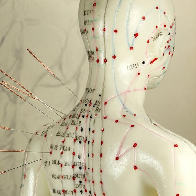 L’acupuncture est une médecine traditionnelle chinoise visant à rééquilibrer la circulation des énergies dans le corps humain.&nbsp;©&nbsp;Björn Wylezich, Adobe Stock.