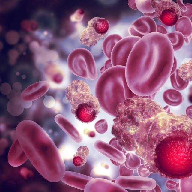 Cancer : ces avancées françaises pourraient transformer les traitements