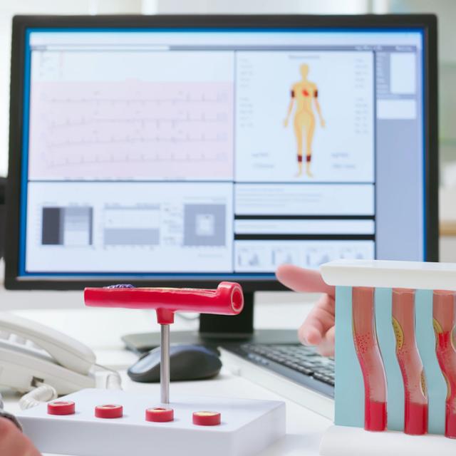 Des chercheurs démontrent qu'un faible taux de « mauvais cholestérol » pourrait protéger contre le risque de démence. ©&nbsp;PonyWang, iStock