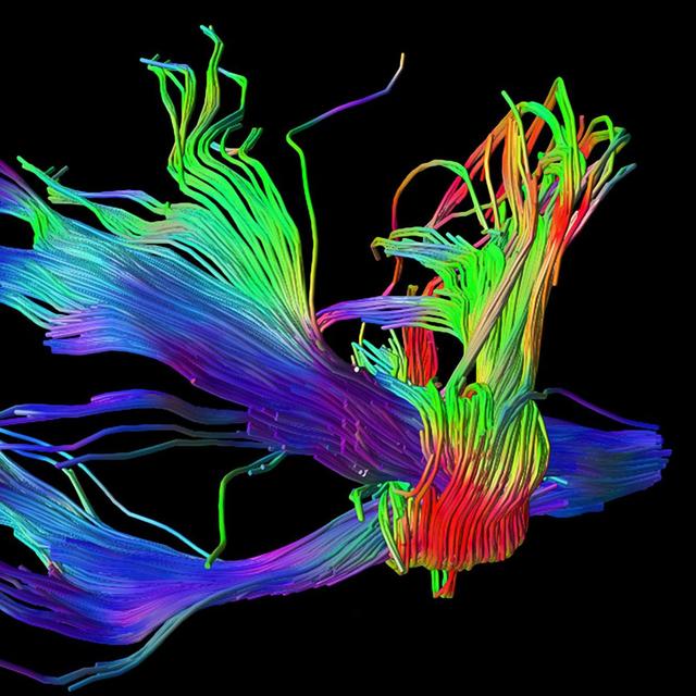 La substance blanche du cerveau étudiée in vivo grâce à la tractographie. La tractographie offre la possibilité d’étudier in vivo la substance blanche du cerveau, celle constituée d’axones myélinisés qui relient les régions de matière grise. Cette gaine de myéline, qui entoure les terminaisons nerveuses, permet à l’information d’être propagée plus rapidement. Sur cette image, les faisceaux pyramidaux apparaissent en bleu et les fibres transverses pontocérebelleuses sont colorées en rouge et vert. © CNRS Photothèque, CI-NAPS, GIP Cyceron