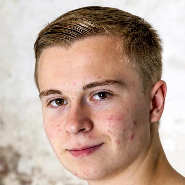 Le traitement de l&#39;acné. © Jorg Hackemann, Shutterstock