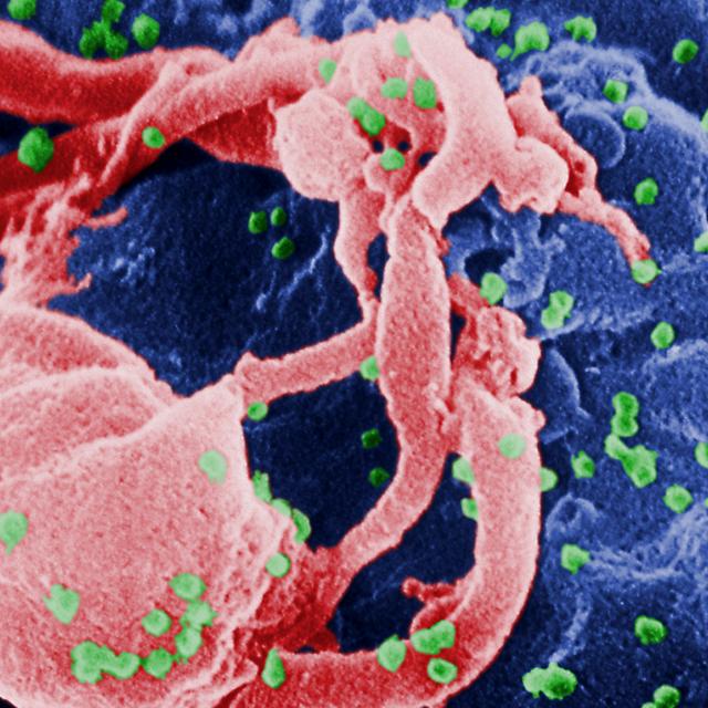 Virus HIV fixé sur un lymphocyte vu en microscopie électronique.&amp;nbsp;© C. Goldsmith - Domaine public