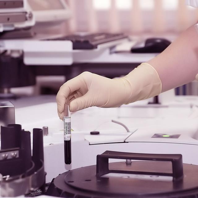 La recherche en thérapie génique.&amp;nbsp;© DarkoStojanovic - Domaine public