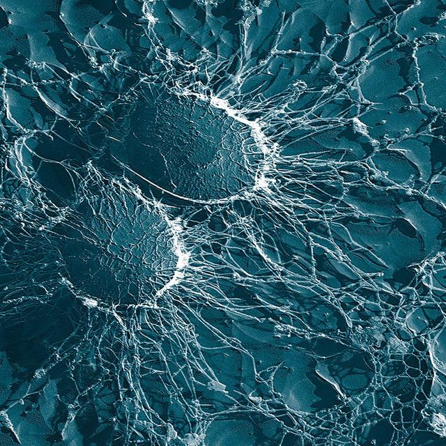 Staphylocoques.&amp;nbsp;© Domaine public