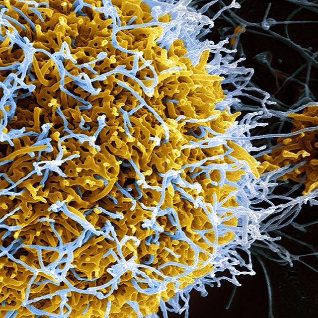 Quels sont les effets des vaccins sur notre système immunitaire ? Ici, un virus. © Niaid, CC by-nc 2.0