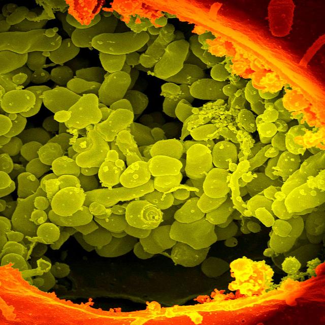 Bactérie&amp;nbsp;Burnetii Coxiella.&amp;nbsp;© NIAID -&amp;nbsp;CC BY 2.0