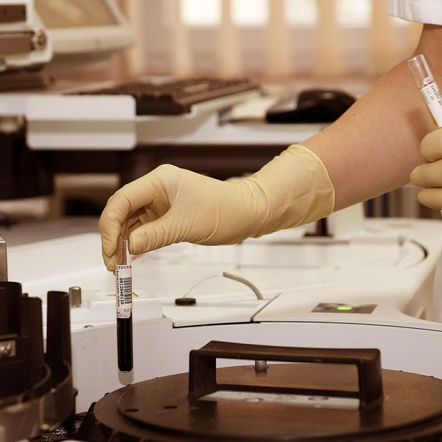 Les virus de redoutables machines à tuer.&amp;nbsp;© Darko Stojanovic - Domaine public