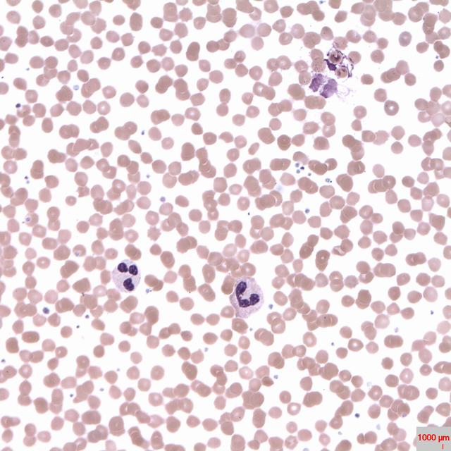 Les polynucléaires sont des globules blancs dont le noyau forme plusieurs lobes. © Prof. Erhabor Osaro, Wikimedia Commons, CC by-sa 4.0