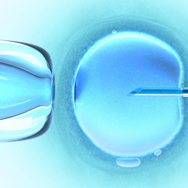 Comment se passe une FIV ? © ktsdesign, Fotolia.com