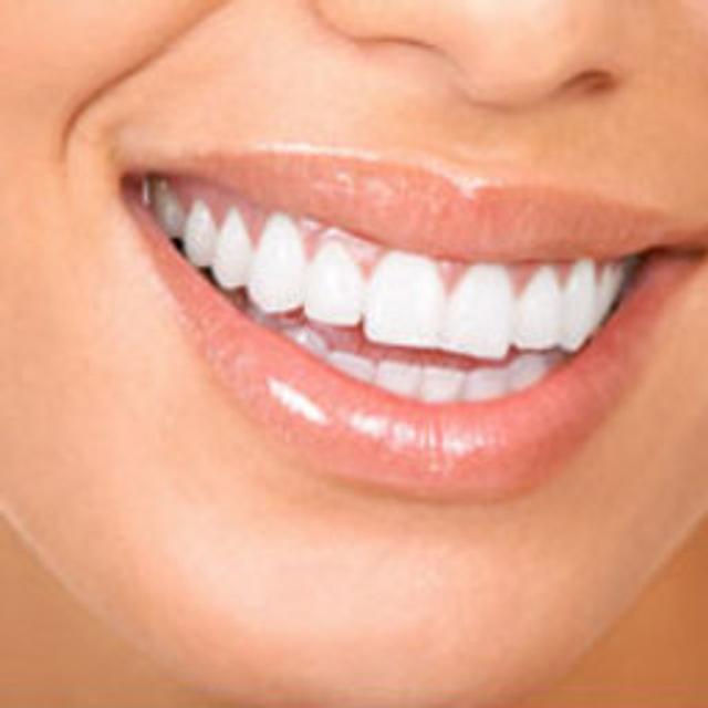 Kits blancheur, dentifrices... Ces méthodes sont-elles efficaces pour avoir des dents blanches ? © Kurhan, Fotolia