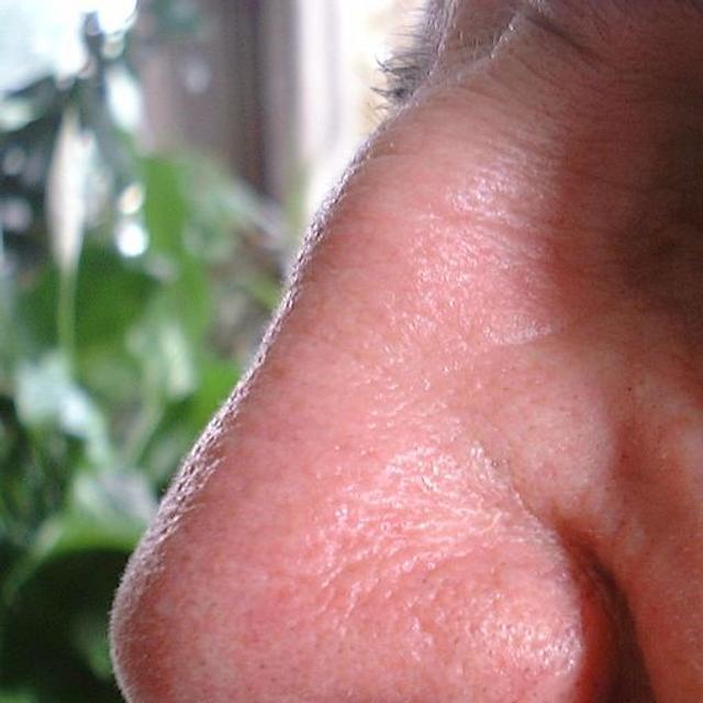 Profil du nez d&#39;un homme adulte - Crédits LHOON  / Wikipedia