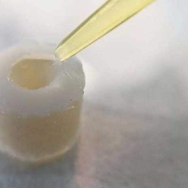 L'arthrose dans le viseur des thérapies ciblées