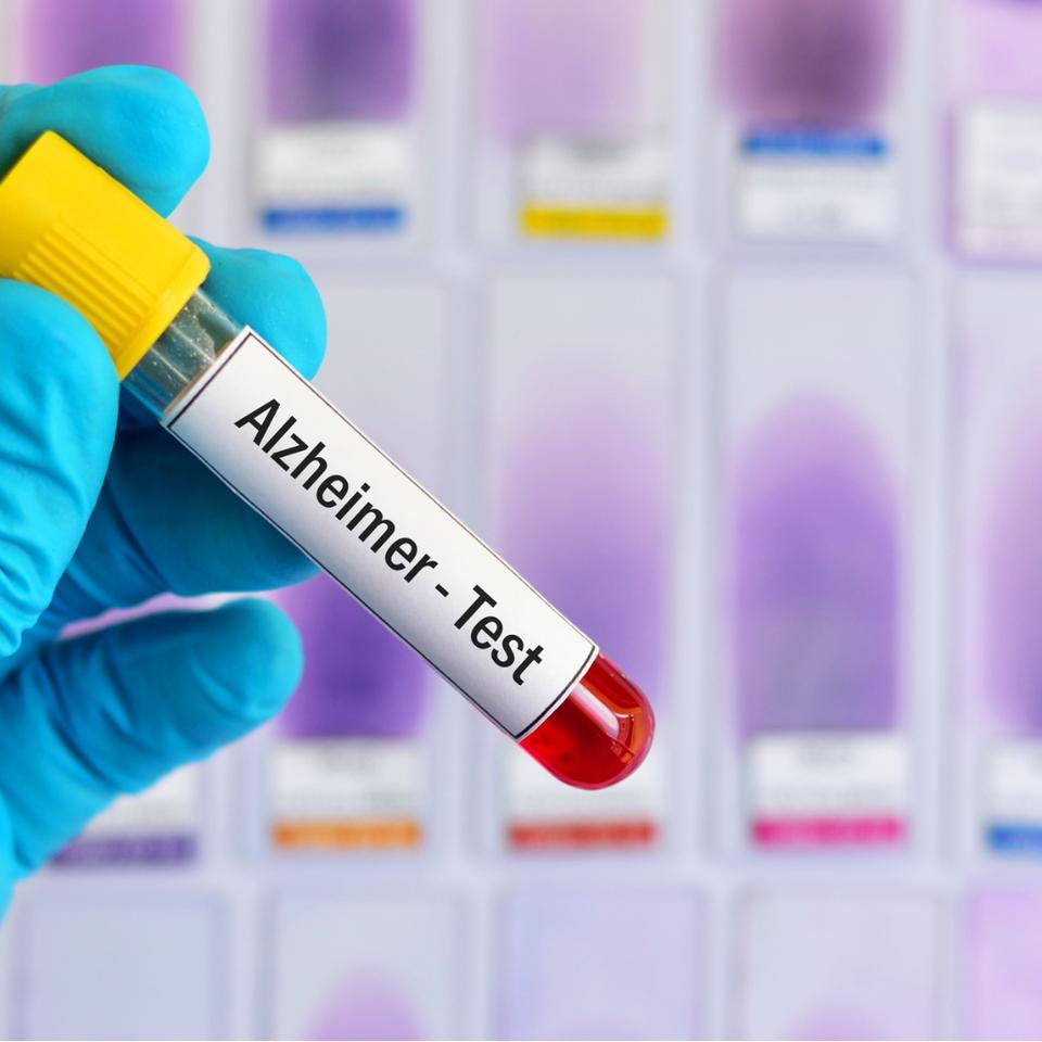 Un nouveau test sanguin révolutionnaire pour détecter la maladie d ...