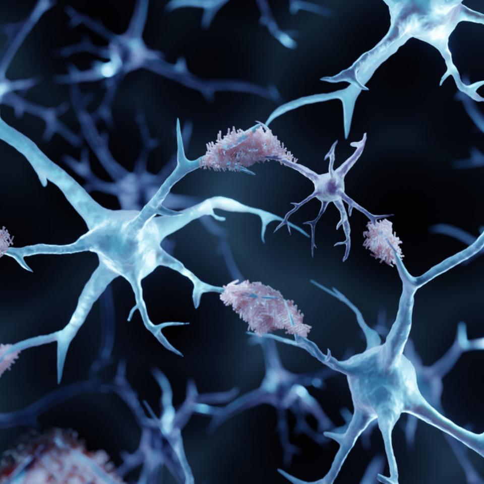 Audition et démence : quel lien les scientifiques ont-ils découvert ? © Artur Plawgo, iStock