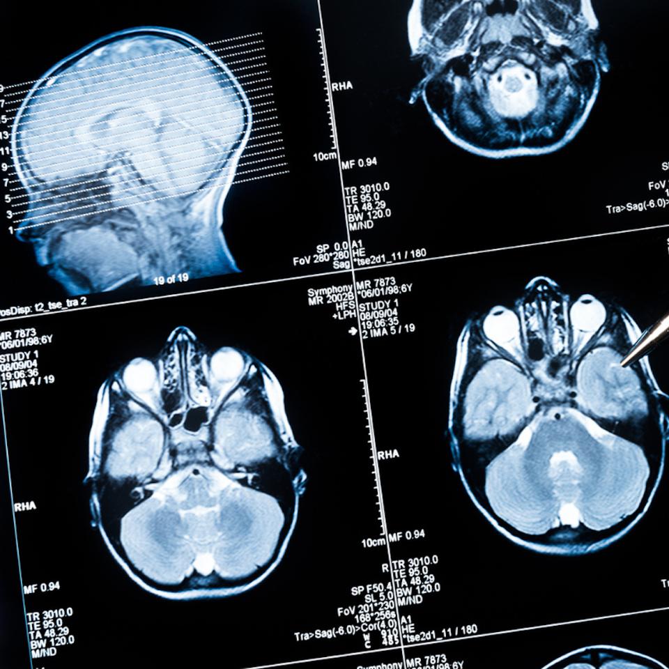 Cette intelligence artificielle pourrait bien nous rendre… un peu plus stupides. © haydenbird, iStock