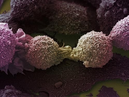 Les bienfaits des antioxydants remis en cause