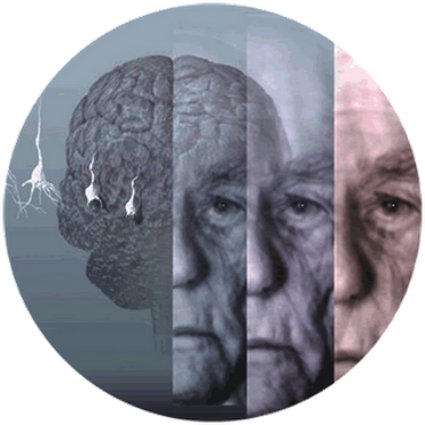 Maladie du cerveau et douleur : les défis de la neuropharmacologie