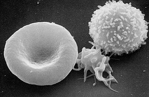 3 cellules sanguines, globules rouge et blanc avec entre les deux un plaquette